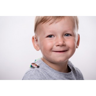 Záchytný klip v praxi - pohled ze předu